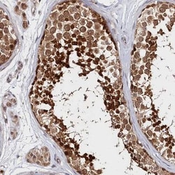 Katanin p60 Antibody, Novus Biologicals:Antibodies:Primary Antibodies