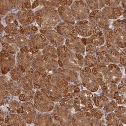 katanin-p80 Antibody, Novus Biologicals 0.1mL; Unlabeled:Antibodies, Polyclonal
