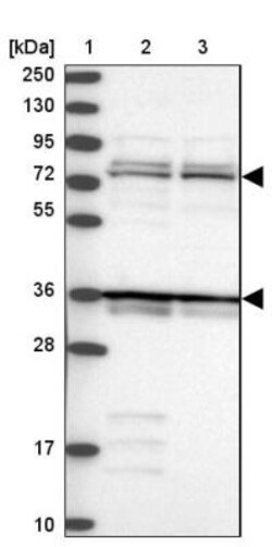 katanin-p80 Antibody, Novus Biologicals 0.1mL; Unlabeled:Antibodies, Polyclonal