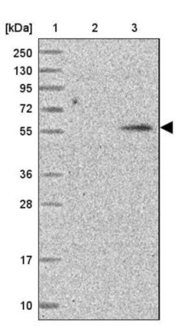 KATNAL2 Antibody, Novus Biologicals:Antibodies:Primary Antibodies