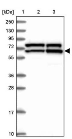 KATNAL2 Antibody, Novus Biologicals 0.1mL; Unlabeled:Antibodies, Polyclonal