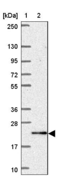 KATNBL1 Antibody, Novus Biologicals:Antibodies:Primary Antibodies