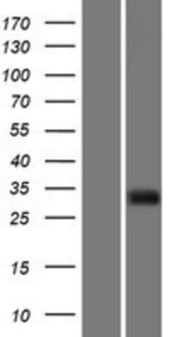 Novus Biologicals&trade;&nbsp;IGFBP-rP10/KAZALD1 Overexpression Lysate