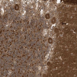 Kazrin Antibody, Novus Biologicals 25 &mu;L, Unconjugated:Antibodies, Polyclonal