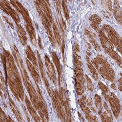 KBTBD3 Antibody, Novus Biologicals 0.1mL; Unlabeled:Antibodies, Polyclonal
