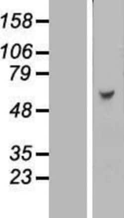 Novus Biologicals&trade;&nbsp;KBTBD4 Overexpression Lysate