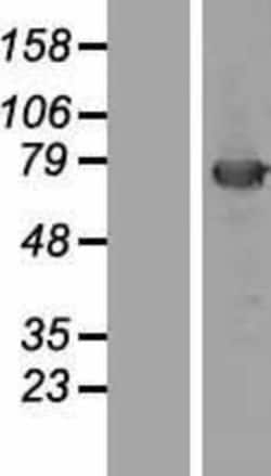 Novus Biologicals&trade;&nbsp;KBTBD5 Overexpression Lysate