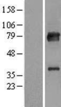 Novus Biologicals&trade;&nbsp;KBTBD7 Overexpression Lysate