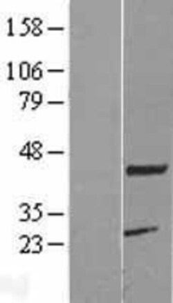 Novus Biologicals&trade;&nbsp;KCMF1 Overexpression Lysate