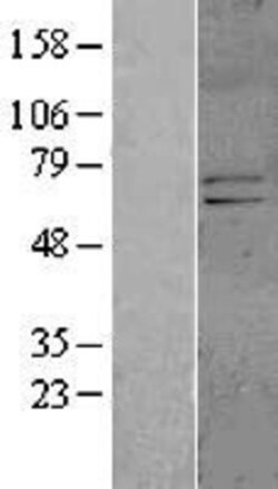 Novus Biologicals™ Kv4.1 Overexpression Lysate