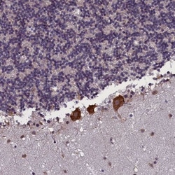 KCNE1-like Antibody, Novus Biologicals:Antibodies:Primary Antibodies
