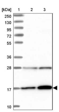 KCNE1-like Antibody, Novus Biologicals:Antibodies:Primary Antibodies