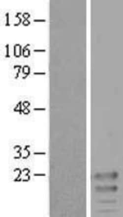 Novus Biologicals&trade;&nbsp;MiRP2 Overexpression Lysate