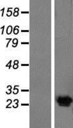 Novus Biologicals&trade;&nbsp;Kv6.4 Overexpression Lysate