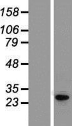 Novus Biologicals&trade;&nbsp;KCNIP4 Overexpression Lysate
