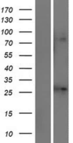 Novus Biologicals&trade;&nbsp;KCNJ1 Overexpression Lysate