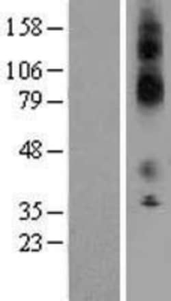 Novus Biologicals™ KCNJ13 Overexpression Lysate