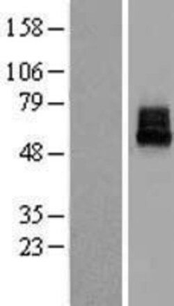 Novus Biologicals™ KCNK10 Overexpression Lysate
