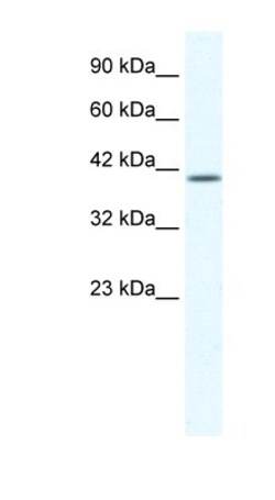 KCNK13 Antibody, Novus Biologicals 100&mu;L; Unlabeled:Antibodies, Polyclonal