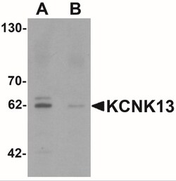KCNK13 Antibody - BSA Free, Novus Biologicals 0.025 mg | Buy Online | Novus Biologicals | Fisher Scientific