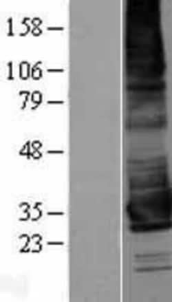 Novus Biologicals&trade;&nbsp;KCNK17 Overexpression Lysate