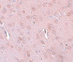 KCNK18 Antibody - BSA Free, Novus Biologicals 0.1mg; Unlabeled:Antibodies,