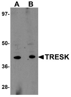 KCNK18 Antibody - BSA Free, Novus Biologicals 0.1mg; Unlabeled:Antibodies,