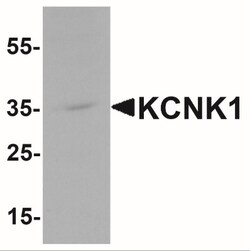 KCNK1 Antibody - BSA Free, Novus Biologicals 0.1mg; Unlabeled:Antibodies,