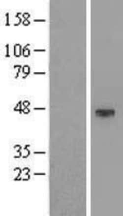 Novus Biologicals&trade;&nbsp;KCNK4 Overexpression Lysate