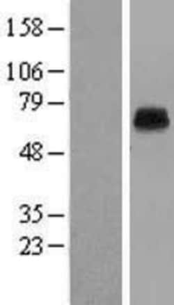 Novus Biologicals&trade;&nbsp;KCNK5 Overexpression Lysate