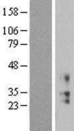 Novus Biologicals&trade;&nbsp;KCNMB2 Overexpression Lysate