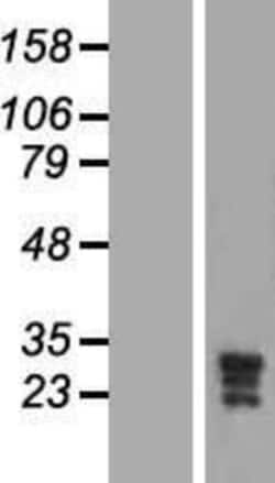 Novus Biologicals&trade;&nbsp;KCNMB3 Overexpression Lysate