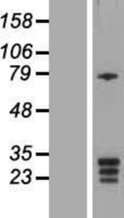 Novus Biologicals™ KCNMB3 Overexpression Lysate