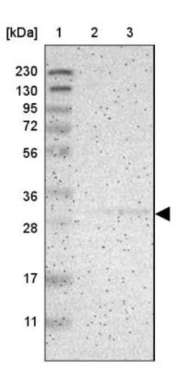 KCNMB3 Antibody, Novus Biologicals 0.1mL; Unlabeled:Antibodies, Polyclonal