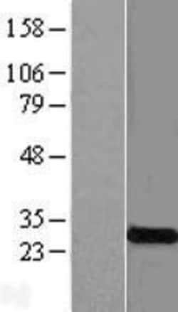 Novus Biologicals&trade;&nbsp;KCNMB4 Overexpression Lysate
