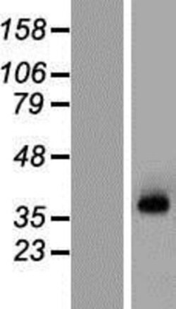 Novus Biologicals™ KCNN3 Overexpression Lysate