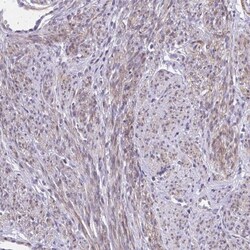 KCNN4 Antibody, Novus Biologicals 0.1mL; Unlabeled:Antibodies, Polyclonal