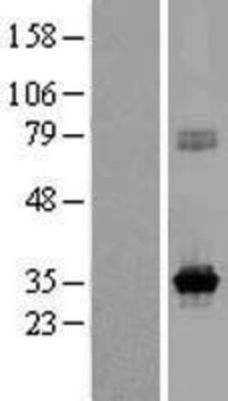 Novus Biologicals&trade;&nbsp;KCNRG Overexpression Lysate