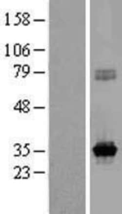 Novus Biologicals&trade;&nbsp;KCNRG Overexpression Lysate