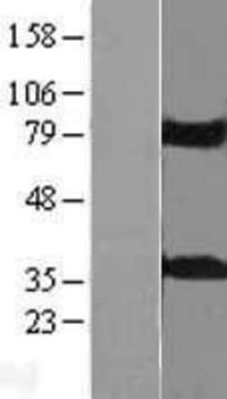 Novus Biologicals&trade;&nbsp;KCTD10 Overexpression Lysate