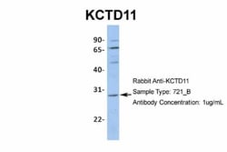 KCTD11 Antibody, Novus Biologicals 100 &mu;L | Buy Online | Novus Biologicals | Fisher Scientific