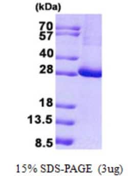 Novus Biologicals&trade;&nbsp;Recombinant Human KCTD11 His Protein