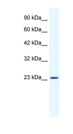 KCTD11 Antibody, Novus Biologicals 100 &mu;L | Buy Online | Novus Biologicals | Fisher Scientific