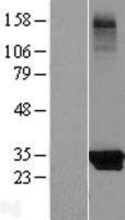 Novus Biologicals™ KCTD14 Overexpression Lysate