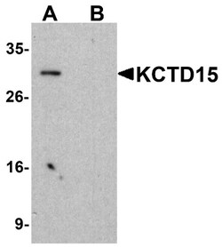 KCTD15 Antibody - BSA Free, Novus Biologicals 0.025 mg, Unconjugated:Antibodies,