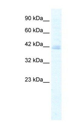 KCTD18 Antibody, Novus Biologicals:Antibodies:Primary Antibodies