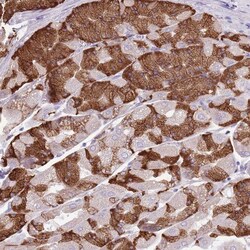 KCTD19 Antibody, Novus Biologicals 25 &mu;L, Unlabeled:Antibodies, Polyclonal