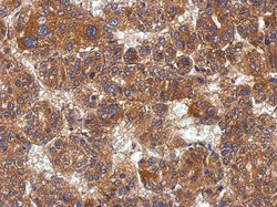 KCTD19 Antibody, Novus Biologicals 0.1mL; Unlabeled:Antibodies, Polyclonal