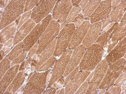 KCTD19 Antibody, Novus Biologicals 0.1mL; Unlabeled:Antibodies, Polyclonal