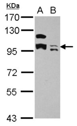 KCTD19 Antibody, Novus Biologicals 0.1mL; Unlabeled:Antibodies, Polyclonal